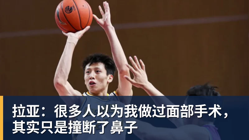 九游体育拉亚:很多人以为我做过面部手术,其实只是撞断了鼻子 九游体育拉亚:很多人以为我做过面部手术,其实只是撞断了鼻子